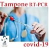 Covid-19: test siero e tampone