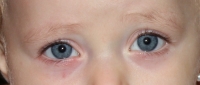 Oftalmologia Pediatrica